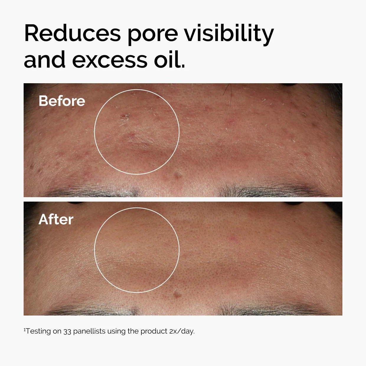 The Ordinary - Niacinamide 10% + Zinc 1% Oil Control Serum 30ml
