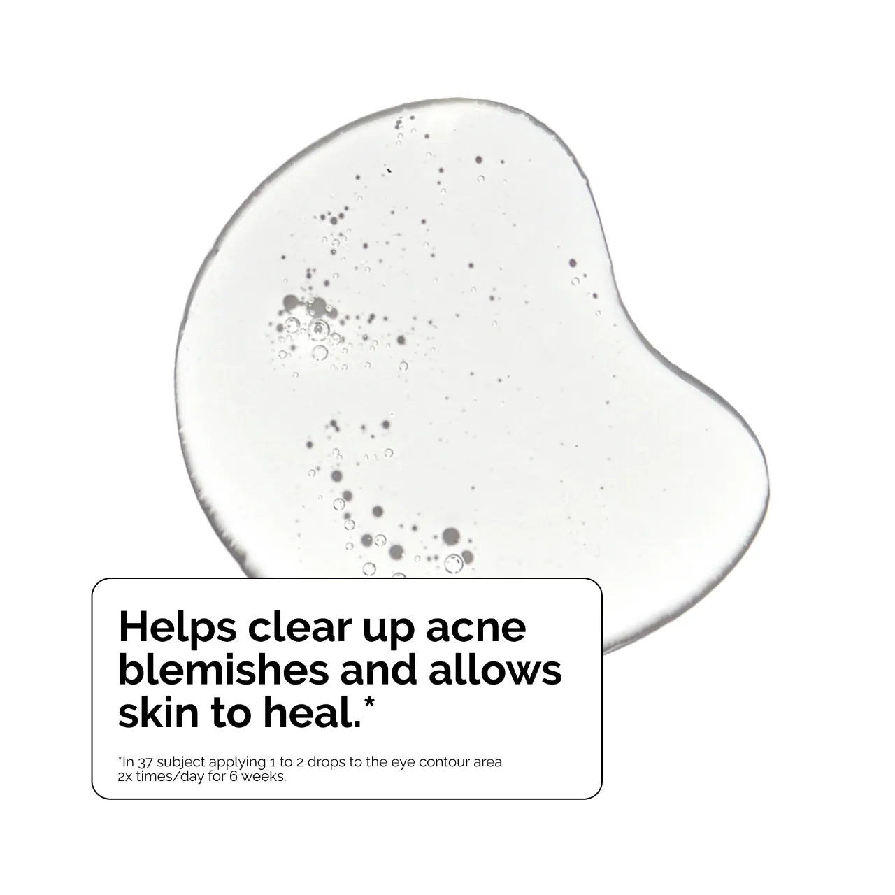 The Ordinary - Salicylic Acid 2% Exfoliating Blemish Solution