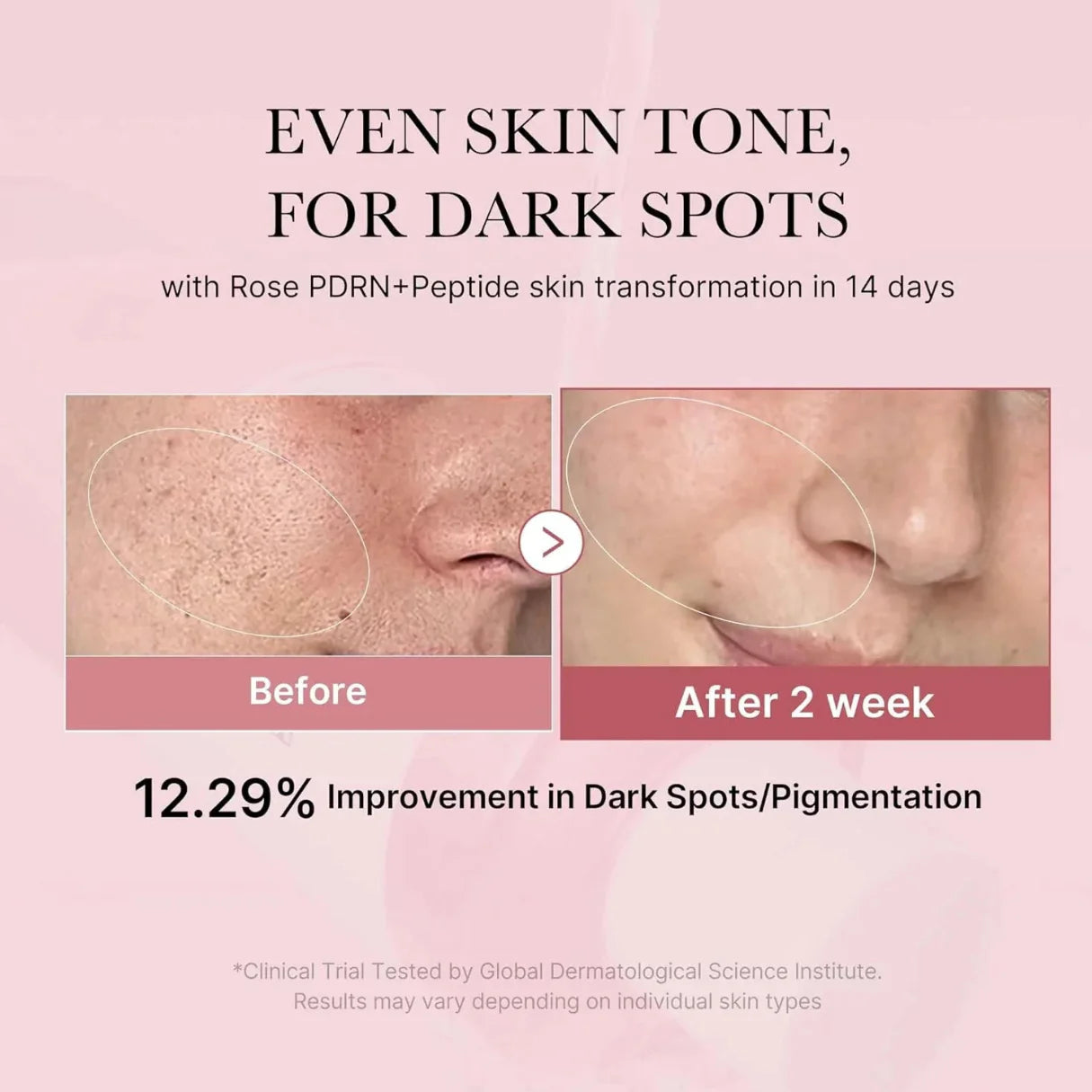 Medicube - PDRN Pink Niacinamide Milky Toner 150ml