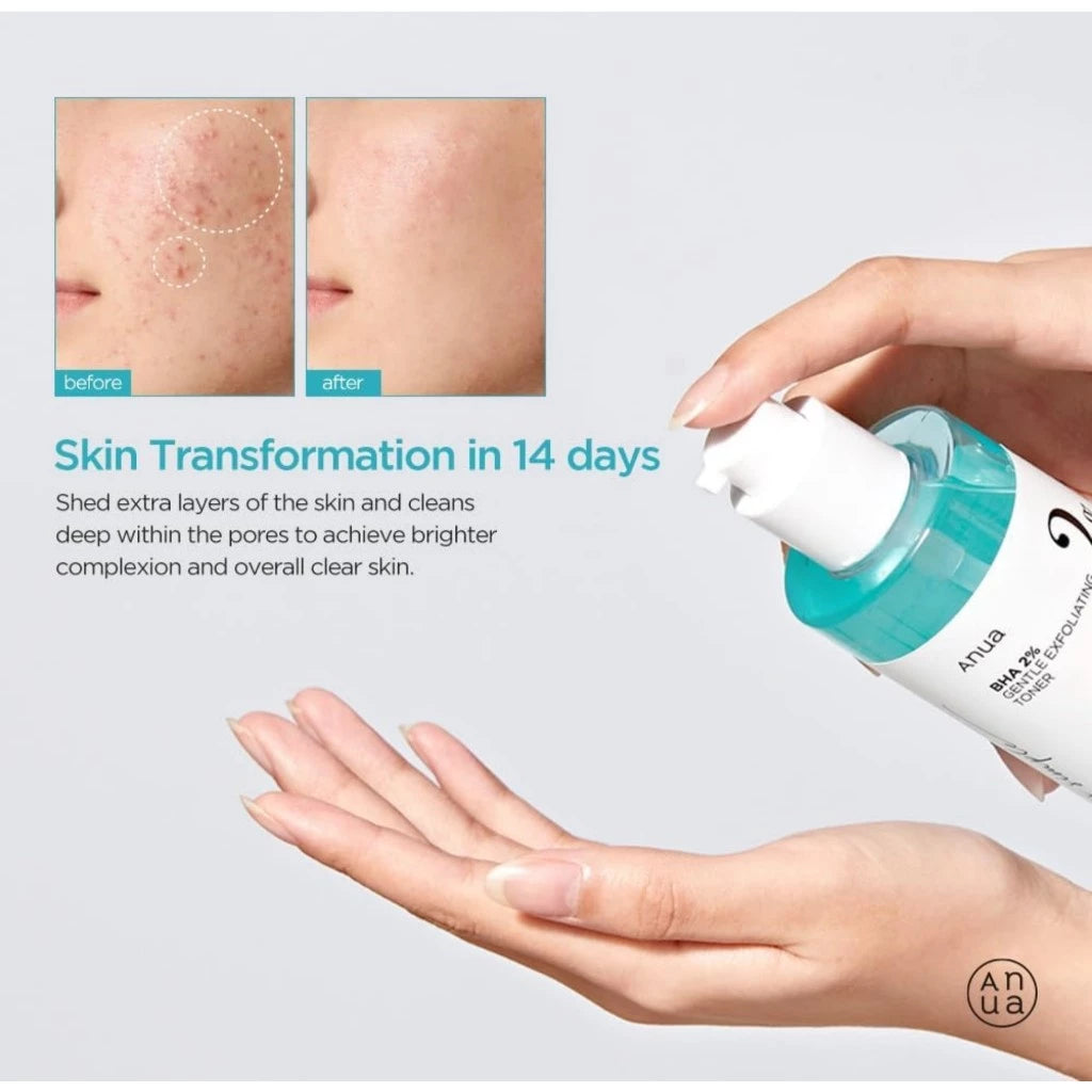 ANUA - BHA 2% Gentle Exfoliating Toner - 150ml