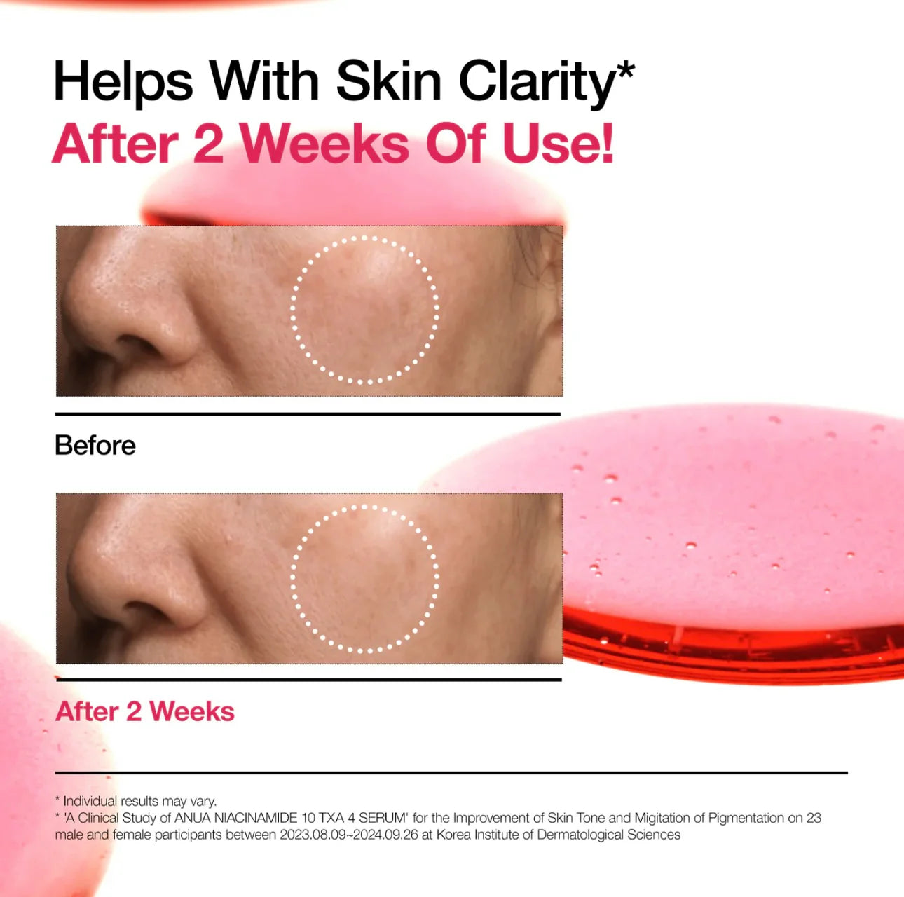 Anua - Niacinamide 10% + TXA 4% Serum | hiperpigmentación